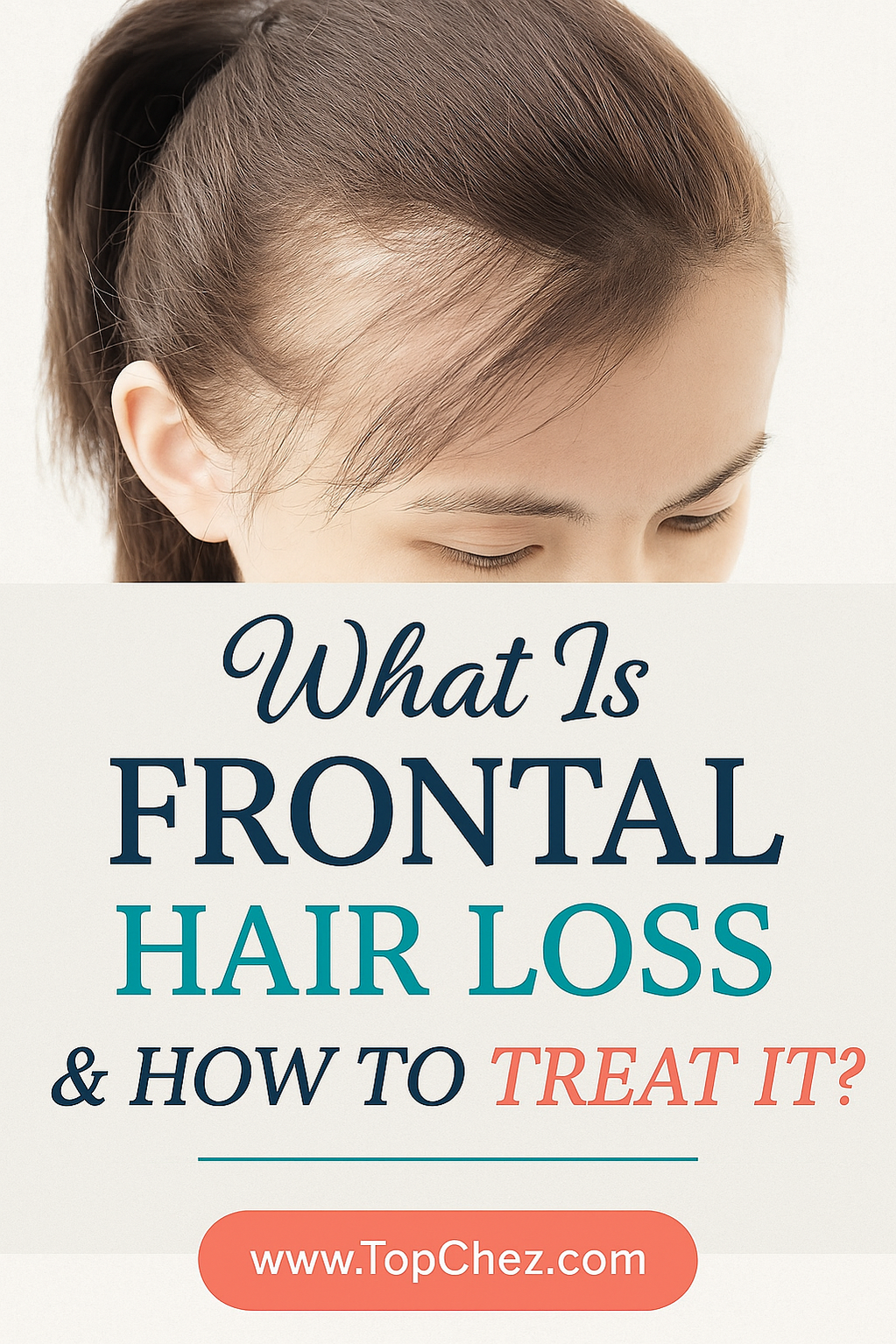 What Is Frontal Hair Loss & How to Treat It? – Grandma’s Gentle Guide Frontal Hair Loss